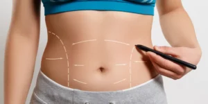 Cirurgia Abdominoplastia: Procedimento Estético 2025