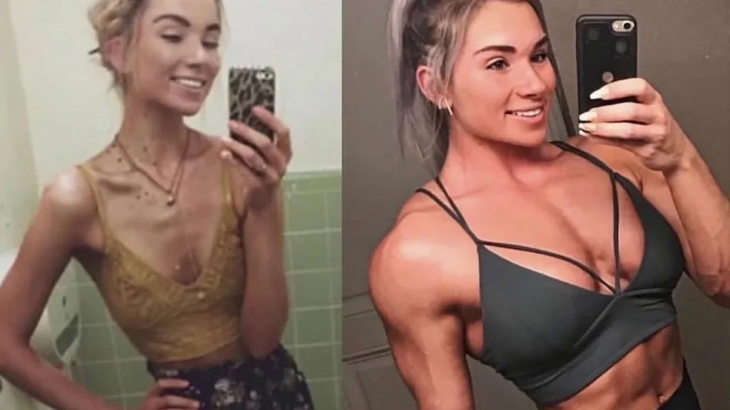 Oxandrolona Antes e Depois