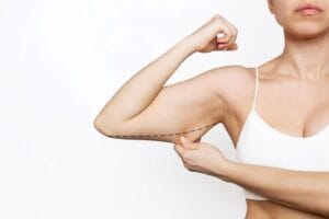 Cirurgia com Argoplasma para Afinar os Braços: Quando é Indicada?