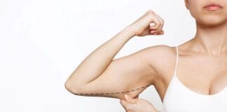 Cirurgia com Argoplasma para Afinar os Braços: Quando é Indicada?