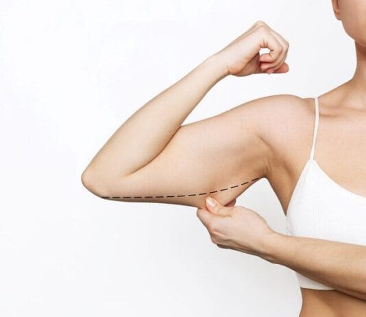 Cirurgia com Argoplasma para Afinar os Braços: Quando é Indicada?