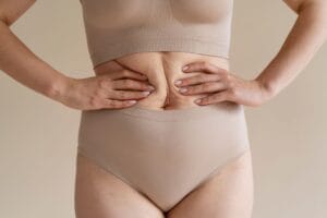 Como a cirurgia robótica corrige a diástase abdominal pós-parto?