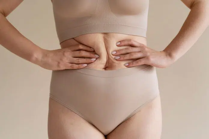 Como-a-cirurgia-robotica-corrige-a-diastase-abdominal-pos-parto.jpg