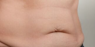 Diástase Abdominal: Cirurgia Robótica É a Melhor Opção?