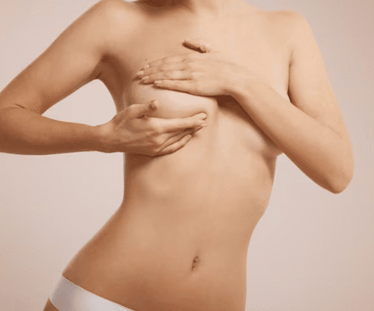 É possível fazer mastopexia sem prótese? Quando é indicada? 2026
