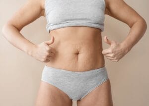 Lipo com Argoplasma: Quais Áreas do Corpo Podem Ser Tratadas?