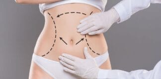 Qual a diferença de abdominoplastia e Lipoabdominoplastia?