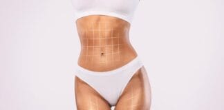 Qual o tempo de recuperação da MILA e quais os cuidados após