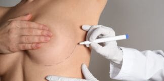 A mamoplastia de recuperação rápida é segura?