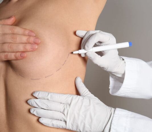 A mamoplastia de recuperação rápida é segura?