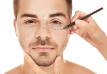 Entenda o que é e como é realizada a blefaroplastia?