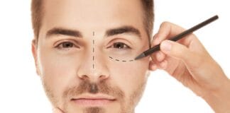 Entenda o que é e como é realizada a blefaroplastia?