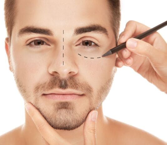 Entenda o que é e como é realizada a blefaroplastia?