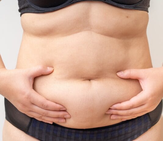O que é a abdominoplastia? Conheça os detalhes do procedimento