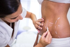 Onde realizar lipoaspiração a laser em São Paulo