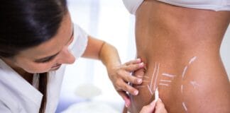 Onde realizar lipoaspiração a laser em São Paulo