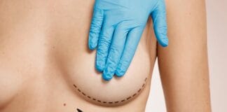 Qual a diferença de mastopexia e mamoplastia?