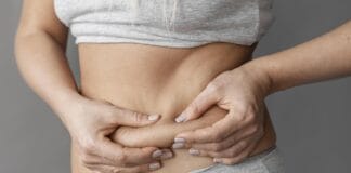 Quem faz lipo pode voltar a ter barriga? Como é após a cirurgia.