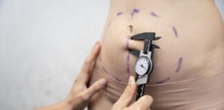 Tudo sobre abdominoplastia, resultados, indicações e benefícios