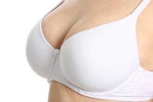 Cirurgia plástica para mastopexia em L em SP