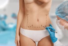 Médico para Lipo Renuvion em São Paulo