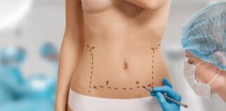 Médico para Lipo Renuvion em São Paulo