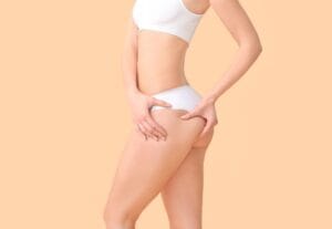 Tudo o que você precisa saber sobre gluteoplastia com prótese em São Paulo