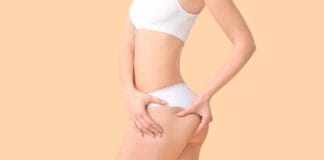 Tudo o que você precisa saber sobre gluteoplastia com prótese em São Paulo