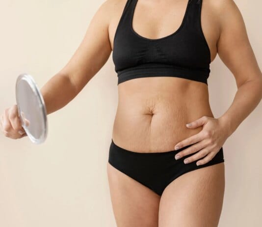 Abdominoplastia em São Paulo: quando a cirurgia para retirar excesso de pele é indicada?